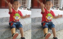 Cuộc sống trên chiếc chân giả của em bé 'văng khỏi bụng mẹ'
