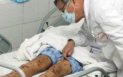 Sự nguy hiểm của bệnh viêm não mô cầu thiếu nữ mắc, 14 người phải cách ly