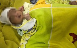 Chữa đau mắt bằng kinh nghiệm dân gian, bé 15 ngày tuổi suýt bị mù