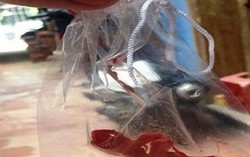 Bác sĩ quên gạc đã bị đình chỉ phẫu thuật