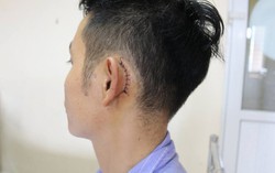 Cắm sạc điện thoại để bên đầu giường khi ngủ, bệnh nhân bị thủng màng nhĩ