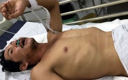 Ăn cá nướng, vợ tử vong, chồng nguy kịch