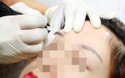 3 biến chứng thường gặp khi phun xăm lông mày