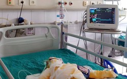 3 trẻ mầm non bị bỏng do học phòng chống cháy nổ hiện ra sao?