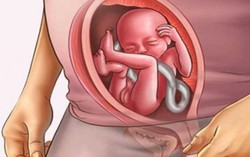 Làm gì khi bị chẩn đoán ngôi thai ngược?