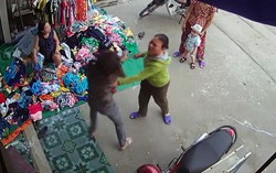 Đánh người chấn thương sọ não nhưng vẫn nhởn nhơ?