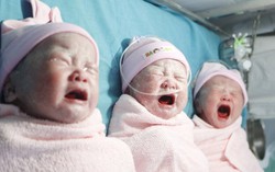 Sản phụ sinh 3 thành công trên nền vết mổ cũ 