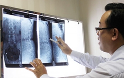 Cơn đau ứa nước mắt