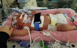 Em bé sơ sinh qua đời vì nụ hôn của người lạ