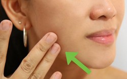 7 công dụng mới được phát hiện của thuốc tránh thai