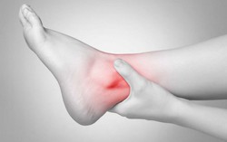 Phụ nữ tiền mãn kinh chớ xem thường bệnh gout