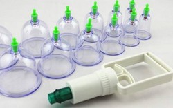 Khỏe hơn nhờ… giác hơi