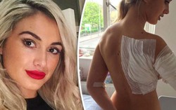 Vụ tấn công axit kinh hoàng ở London