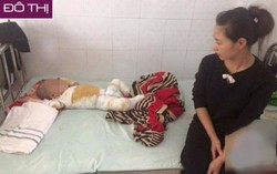 Mẹ bất cẩn khiến bé trai 2 tuổi ngã vào nồi nước sôi