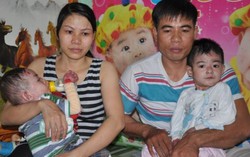 2 anh em cùng mắc bệnh lạ