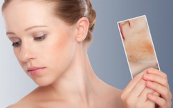 Xử trí các bệnh về da thường gặp trong mùa hè