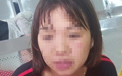 Mất 2,8 triệu cắt bao quy đầu, không ngờ con bị sùi mào gà