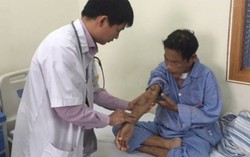 Hormone lấy canxi trong máu khiến xương mặt biến dạng