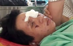 Nổ đầu đạn khi đốt rác, thai phụ mù mắt