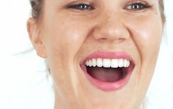 Làm răng trắng xinh bằng… vỏ chuối