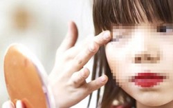 Nhiều bệnh nguy hiểm rình rập trẻ dậy thì sớm