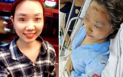 Đã bắt 3 nghi can tạt axit nữ sinh
