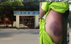 Cô giáo tiểu học đánh trò bầm tím, Sở, Phòng nhận trách nhiệm