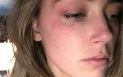 Amber Heard tố Johnny Depp bạo hành