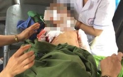 Bị chó nhà vừa mua về nuôi cắn, bé 7 tuổi khó qua khỏi