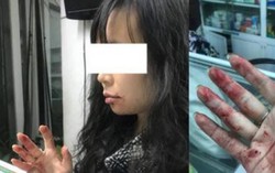 Tài xế Uber đấm vào mặt người phụ nữ đi cùng con nhỏ