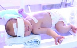 Thay máu cứu bệnh nhi 5 ngày tuổi bị vàng da nặng