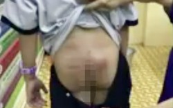Làm rõ nghi vấn mẹ kế bạo hành bé trai 10 tuổi