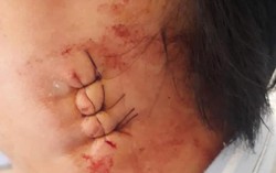 Gia đình tố BV Bệnh Nhiệt đới TƯ chẩn đoán sai, BV Bạch Mai mổ không cần khám lại