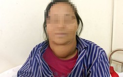 Người phụ nữ 20 năm mang khối u ‘khủng’ ở cổ mà không điều trị
