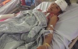 2 chị em gái bị đa chấn thương nặng vì sập lò gạch