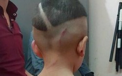 Đưa vụ bé trai 3 tuổi bị cha dượng bạo hành tại Phú Quốc làm án điểm để xử sớm
