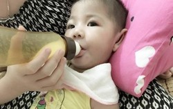 Thay đổi ngoạn mục của bé 14 tháng nặng… 3,5kg 