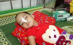 Nếu trẻ có biểu hiện này, cần nghĩ bé bị viêm não