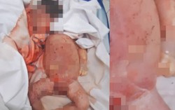 Vụ trẻ sơ sinh tử vong ở Hà Tĩnh: Bệnh viện xác nhận trẻ bị kéo đứt lìa cổ 