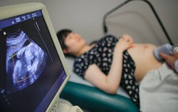 Trào lưu phụ nữ Trung Quốc đua nhau sang Mỹ sinh con