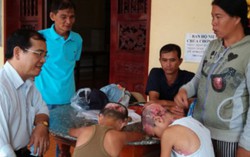  Bệnh lạ của 2 anh em ruột cứ chạm vào da là lở loét