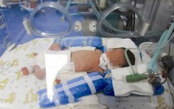 Bé sơ sinh bị vứt bỏ trong sọt rác nhà vệ sinh nữ công cộng