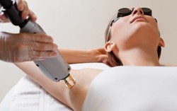 Những lỗi thường mắc khi tẩy lông bằng laze