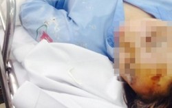 Bắt giữ một người nghi tạt axit nữ sinh