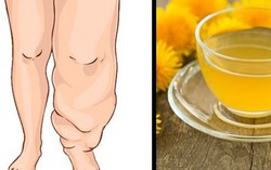 10 thực phẩm và đồ uống giúp cơ thể không bị phù nề