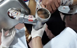 Bé 5 tuổi bị nát bàn tay vì máy xay thịt