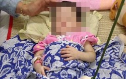 TPHCM: Nghi án ‘mẹ nuôi’ bạo hành bé 1 tuổi đến gãy chân