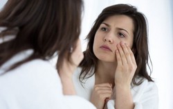 Đau đầu với ‘khách không mời’
