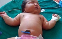 Bé gái sơ sinh 6,8kg nặng nhất thế giới