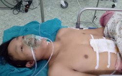 Cứu sống bệnh nhân bị vật nhọn đâm thấu bụng